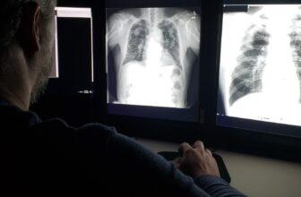 Lung Energy Peaks in Our 20s—and It is a Regular Decline From There, Research Finds